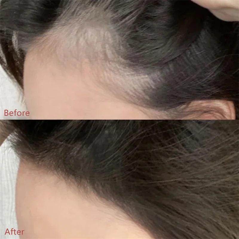 HairPerfect - Pó para Cobertura de Raízes e Linha Capilar - Allure Place